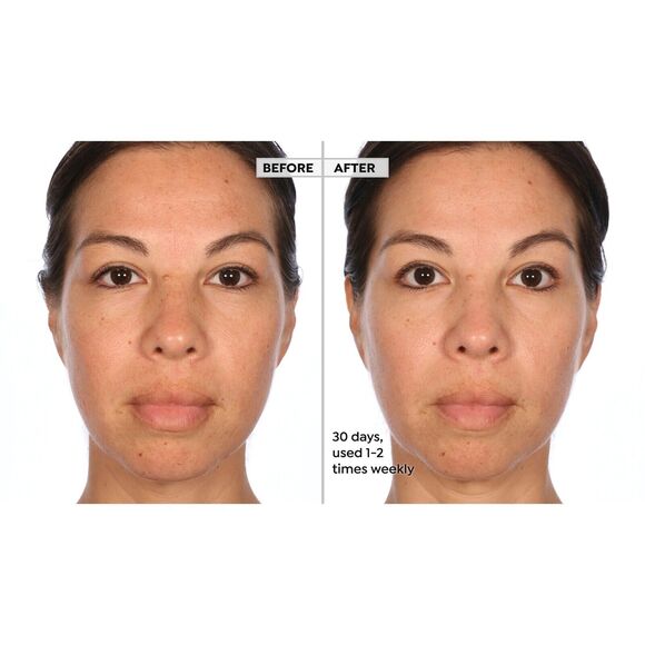 Active Argan Resurface Accelerating Peel Activated Argan Complex, 1.0 fl oz. New - Picture 2 of 16